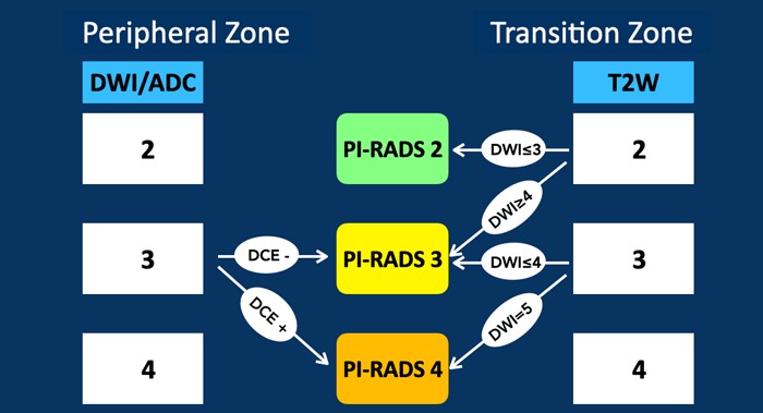 PI-RADS v2.1 decision flowchart showing peripheral zone DWI/ADC plus DCE, and transition zone T2W plus DWI, converging on the final PI-RADS 2, 3 or 4 category